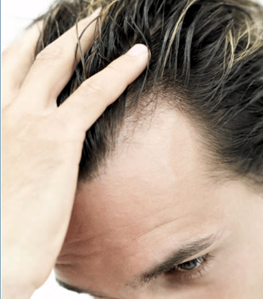 Da li slaba kosa oslikava loše zdravlje?