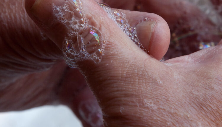 Čudna posledica korišćenja gela za dezinfekciju ruku