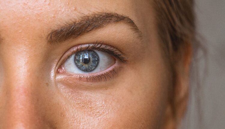 Najjeftiniji lek za podočnjake: Smesa od 2 sastojka zateže kožu oko očiju bolje od krema